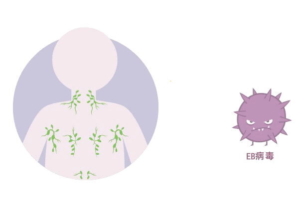 體檢查出“EB病毒”陽(yáng)性！一定就是鼻咽癌嗎？