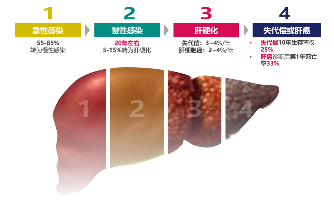 悄悄變成肝硬化、肝癌，很多人感染了卻不知道